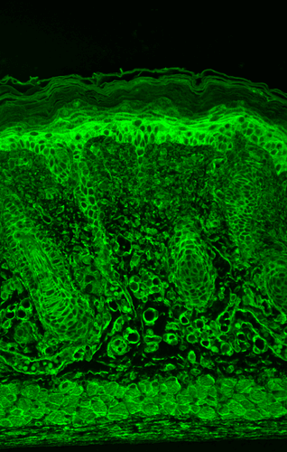 Mouse Anti-HIF1 alpha Antibody [ESEE122] used in Immunohistochemistry (IHC) on Mouse backskin (SMC-184)