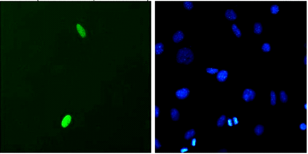 Mouse Anti-DUX4 Antibody [P2B1] used in Immunocytochemistry/Immunofluorescence (ICC/IF) on Mouse C2C12 myoblast cells (SMC-192)