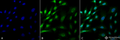 Mouse Anti-Ubiquitin Antibody [FK1] used in Immunocytochemistry/Immunofluorescence (ICC/IF) on Mouse Fibroblast cell line (NIH 3T3) (SMC-213)