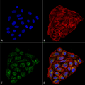 Mouse Anti-CD74 Antibody [1B8 ] used in Immunocytochemistry/Immunofluorescence (ICC/IF) on Human Cervical cancer cell line (HeLa) (SMC-267)