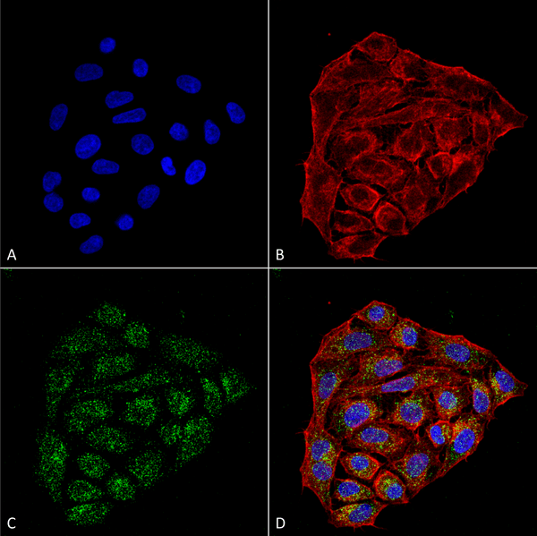 Mouse Anti-CD74 Antibody [1B8 ] used in Immunocytochemistry/Immunofluorescence (ICC/IF) on Human Cervical cancer cell line (HeLa) (SMC-267)