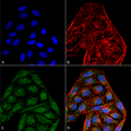 Mouse Anti-CD74 Antibody [6D9 ] used in Immunocytochemistry/Immunofluorescence (ICC/IF) on Human Cervical cancer cell line (HeLa) (SMC-269)