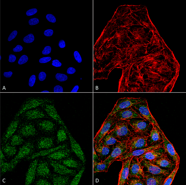 Mouse Anti-CD74 Antibody [6D9 ] used in Immunocytochemistry/Immunofluorescence (ICC/IF) on Human Cervical cancer cell line (HeLa) (SMC-269)