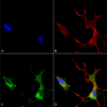 Mouse Anti-Cav1.2 Antibody [S57] used in Immunocytochemistry/Immunofluorescence (ICC/IF) on Human Neuroblastoma cells (SH-SY5Y) (SMC-300)