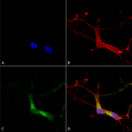 Mouse Anti-HCN1 Antibody [S70] used in Immunocytochemistry/Immunofluorescence (ICC/IF) on Human Neuroblastoma cells (SH-SY5Y) (SMC-304)