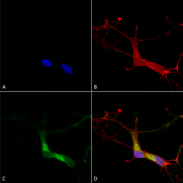 Mouse Anti-HCN1 Antibody [S70] used in Immunocytochemistry/Immunofluorescence (ICC/IF) on Human Neuroblastoma cells (SH-SY5Y) (SMC-304)