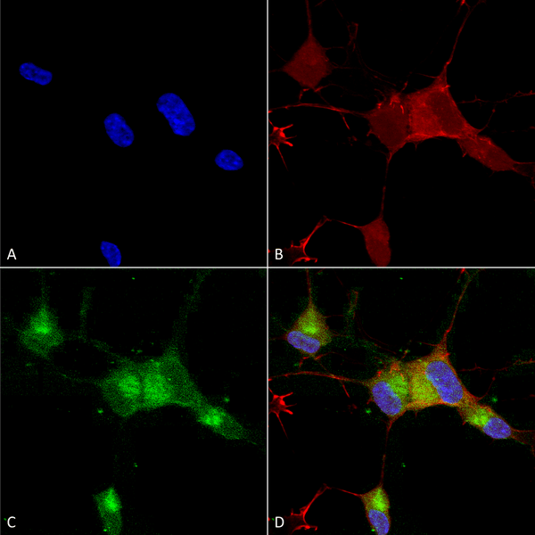 Mouse Anti-Nav1.7 Antibody [N68/6] used in Immunocytochemistry/Immunofluorescence (ICC/IF) on Human Neuroblastoma cells (SH-SY5Y) (SMC-314)