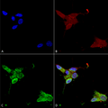 Mouse Anti-TrpM7 Antibody [S74] used in Immunocytochemistry/Immunofluorescence (ICC/IF) on Human Neuroblastoma cells (SH-SY5Y) (SMC-316)