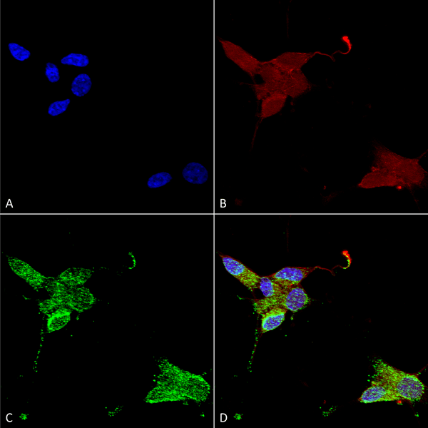 Mouse Anti-TrpM7 Antibody [S74] used in Immunocytochemistry/Immunofluorescence (ICC/IF) on Human Neuroblastoma cells (SH-SY5Y) (SMC-316)