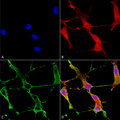 Mouse Anti-SHANK1 Antibody [N22/21] used in Immunocytochemistry/Immunofluorescence (ICC/IF) on Human Neuroblastoma cells (SH-SY5Y) (SMC-329)