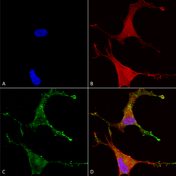 Mouse Anti-Cav beta 2 Antibody [N8b/1] used in Immunocytochemistry/Immunofluorescence (ICC/IF) on Human Neuroblastoma cells (SH-SY5Y) (SMC-332)
