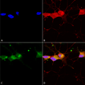 Mouse Anti-GluN2B Antibody [S59] used in Immunocytochemistry/Immunofluorescence (ICC/IF) on Human Neuroblastoma cells (SH-SY5Y) (SMC-337)