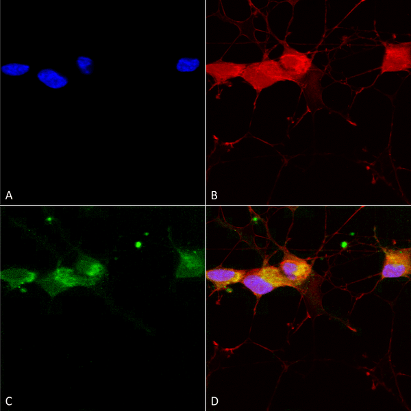 Mouse Anti-GluN2B Antibody [S59] used in Immunocytochemistry/Immunofluorescence (ICC/IF) on Human Neuroblastoma cells (SH-SY5Y) (SMC-337)