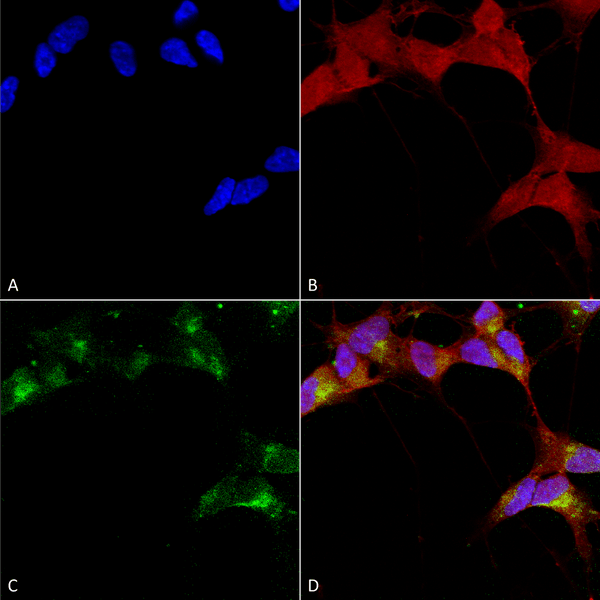 Mouse Anti-GABA-A Receptor Beta 3 Antibody [N87/25] used in Immunocytochemistry/Immunofluorescence (ICC/IF) on Human Neuroblastoma cells (SH-SY5Y) (SMC-339)