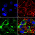 Mouse Anti-Nav1.8 Antibody [S134] used in Immunocytochemistry/Immunofluorescence (ICC/IF) on Human Neuroblastoma cells (SH-SY5Y) (SMC-342)