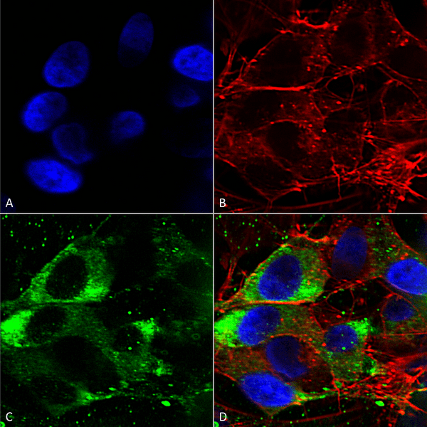 Mouse Anti-Nav1.8 Antibody [S134] used in Immunocytochemistry/Immunofluorescence (ICC/IF) on Human Neuroblastoma cells (SH-SY5Y) (SMC-342)