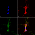 Mouse Anti-TrpC7 Antibody [N64A/36] used in Immunocytochemistry/Immunofluorescence (ICC/IF) on Human Neuroblastoma cells (SH-SY5Y) (SMC-343)