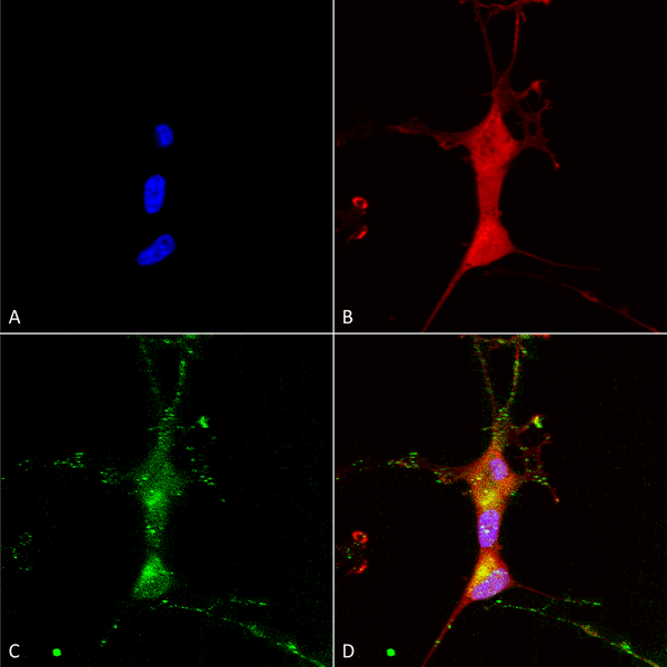 Mouse Anti-TrpC7 Antibody [N64A/36] used in Immunocytochemistry/Immunofluorescence (ICC/IF) on Human Neuroblastoma cells (SH-SY5Y) (SMC-343)