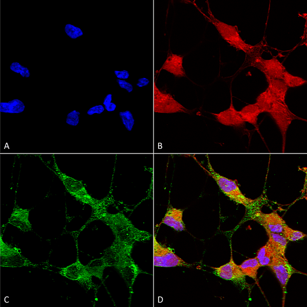 Mouse Anti-TrpC5 Antibody [N67/15] used in Immunocytochemistry/Immunofluorescence (ICC/IF) on Human Neuroblastoma cells (SH-SY5Y) (SMC-344)