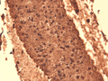 Mouse Anti-Sodium Iodide Symporter Antibody [14F] used in Immunohistochemistry (IHC) on Mouse Thyroid (SMC-390)