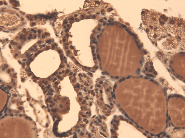 Mouse Anti-Sodium Iodide Symporter Antibody [14F] used in Immunohistochemistry (IHC) on Mouse Thyroid (SMC-391)