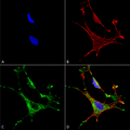 Mouse Anti-MMP9 Antibody [L51/82] used in Immunocytochemistry/Immunofluorescence (ICC/IF) on Human Neuroblastoma cells (SH-SY5Y) (SMC-396)