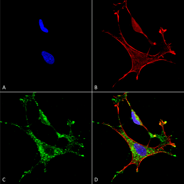 Mouse Anti-MMP9 Antibody [L51/82] used in Immunocytochemistry/Immunofluorescence (ICC/IF) on Human Neuroblastoma cells (SH-SY5Y) (SMC-396)