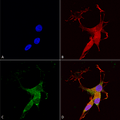 Mouse Anti-VGLUT3 Antibody [N34/34] used in Immunocytochemistry/Immunofluorescence (ICC/IF) on Human Neuroblastoma cells (SH-SY5Y) (SMC-397)