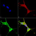 Mouse Anti-Copper Transporting ATPase 1 Antibody [L60/4] used in Immunocytochemistry/Immunofluorescence (ICC/IF) on Human Neuroblastoma cells (SH-SY5Y) (SMC-398)