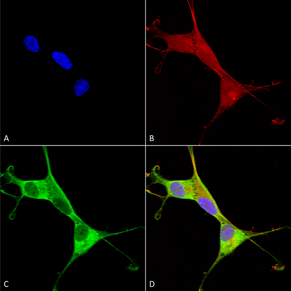 Mouse Anti-Copper Transporting ATPase 1 Antibody [L60/4] used in Immunocytochemistry/Immunofluorescence (ICC/IF) on Human Neuroblastoma cells (SH-SY5Y) (SMC-398)