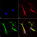 Mouse Anti-Copper Transporting ATPase 2 Antibody [L62/29] used in Immunocytochemistry/Immunofluorescence (ICC/IF) on Human Neuroblastoma cells (SH-SY5Y) (SMC-399)
