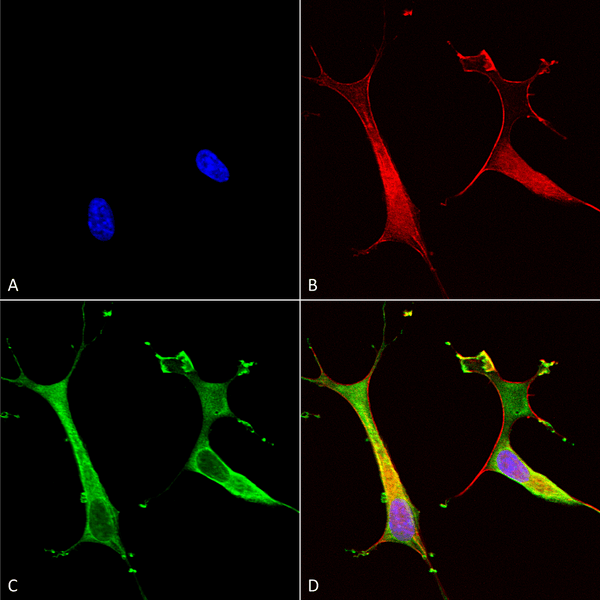 Mouse Anti-Copper Transporting ATPase 2 Antibody [L62/29] used in Immunocytochemistry/Immunofluorescence (ICC/IF) on Human Neuroblastoma cells (SH-SY5Y) (SMC-399)