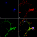 Mouse Anti-GABA-B Receptor 1 Antibody [N93A/49] used in Immunocytochemistry/Immunofluorescence (ICC/IF) on Human Neuroblastoma cells (SH-SY5Y) (SMC-403)