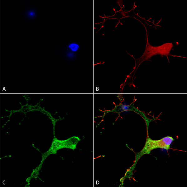 Mouse Anti-GABA-B Receptor 1 Antibody [N93A/49] used in Immunocytochemistry/Immunofluorescence (ICC/IF) on Human Neuroblastoma cells (SH-SY5Y) (SMC-403)