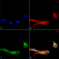 Mouse Anti-mGluR1/5 Antibody [N75/33] used in Immunocytochemistry/Immunofluorescence (ICC/IF) on Human Neuroblastoma cells (SH-SY5Y) (SMC-407)