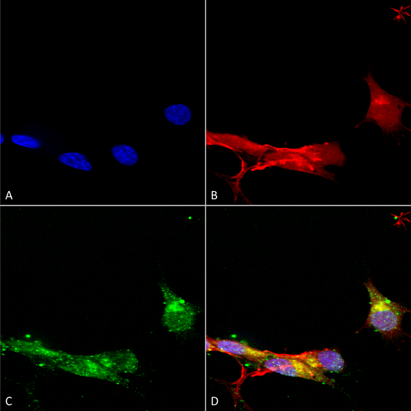 Mouse Anti-mGluR1/5 Antibody [N75/33] used in Immunocytochemistry/Immunofluorescence (ICC/IF) on Human Neuroblastoma cells (SH-SY5Y) (SMC-407)