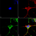 Mouse Anti-Clcn3 Antibody [N258/5] used in Immunocytochemistry/Immunofluorescence (ICC/IF) on Human Neuroblastoma cells (SH-SY5Y) (SMC-408)