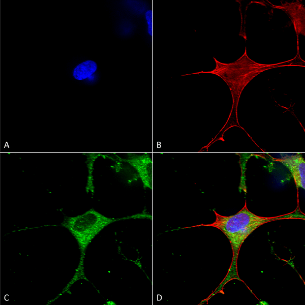 Mouse Anti-Clcn3 Antibody [N258/5] used in Immunocytochemistry/Immunofluorescence (ICC/IF) on Human Neuroblastoma cells (SH-SY5Y) (SMC-408)