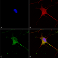 Mouse Anti-SUR1 Antibody [N289/16] used in Immunocytochemistry/Immunofluorescence (ICC/IF) on Human Neuroblastoma cells (SH-SY5Y) (SMC-409)