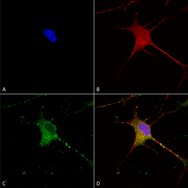 Mouse Anti-SUR1 Antibody [N289/16] used in Immunocytochemistry/Immunofluorescence (ICC/IF) on Human Neuroblastoma cells (SH-SY5Y) (SMC-409)