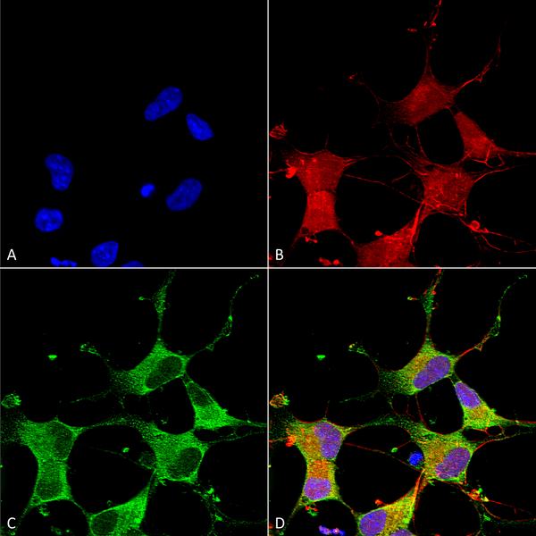 Mouse Anti-GIT1 Antibody [N39B/8] used in Immunocytochemistry/Immunofluorescence (ICC/IF) on Human Neuroblastoma cells (SH-SY5Y) (SMC-413)