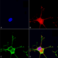 Mouse Anti-Dicer Antibody [N167/7] used in Immunocytochemistry/Immunofluorescence (ICC/IF) on Human Neuroblastoma cells (SH-SY5Y) (SMC-416)