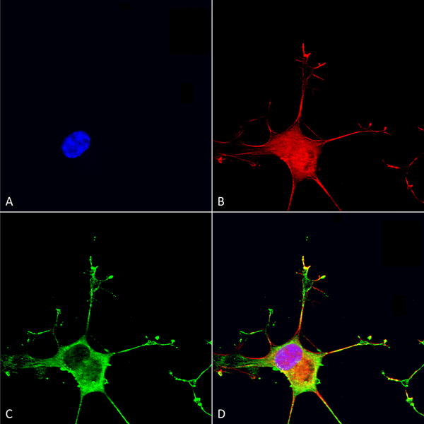 Mouse Anti-Dicer Antibody [N167/7] used in Immunocytochemistry/Immunofluorescence (ICC/IF) on Human Neuroblastoma cells (SH-SY5Y) (SMC-416)