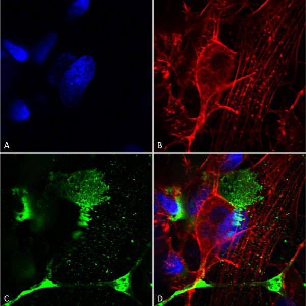 Mouse Anti-LRP4 (Extracellular) Antibody [N207/27] used in Immunocytochemistry/Immunofluorescence (ICC/IF) on Human Neuroblastoma cells (SH-SY5Y) (SMC-418)
