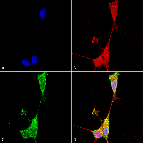 Mouse Anti-Brevican Antibody [N294A/6] used in Immunocytochemistry/Immunofluorescence (ICC/IF) on Human Neuroblastoma cells (SH-SY5Y) (SMC-428)