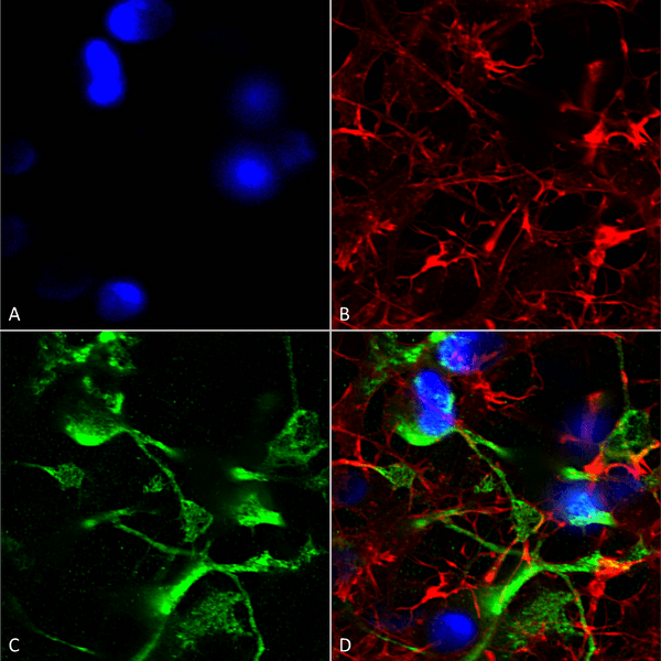 Mouse Anti-SUR2A Antibody [N319A/14] used in Immunocytochemistry/Immunofluorescence (ICC/IF) on Human Neuroblastoma cells (SH-SY5Y) (SMC-431)