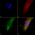 Mouse Anti-GluN2A Antibody [N327A/38] used in Immunocytochemistry/Immunofluorescence (ICC/IF) on Human Neuroblastoma cells (SH-SY5Y) (SMC-434)