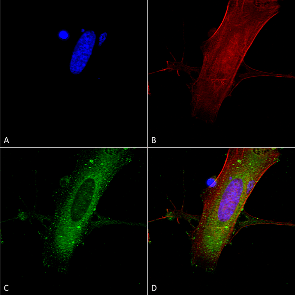 Mouse Anti-GluN2A Antibody [N327A/38] used in Immunocytochemistry/Immunofluorescence (ICC/IF) on Human Neuroblastoma cells (SH-SY5Y) (SMC-434)