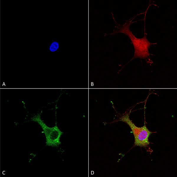 Mouse Anti-Alpha-2C Adrenergic Receptor Antibody [N330A/80] used in Immunocytochemistry/Immunofluorescence (ICC/IF) on Human Neuroblastoma cells (SH-SY5Y) (SMC-435)