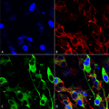 Mouse Anti-Versican Antibody [N351/23] used in Immunocytochemistry/Immunofluorescence (ICC/IF) on Human Neuroblastoma cells (SH-SY5Y) (SMC-439)